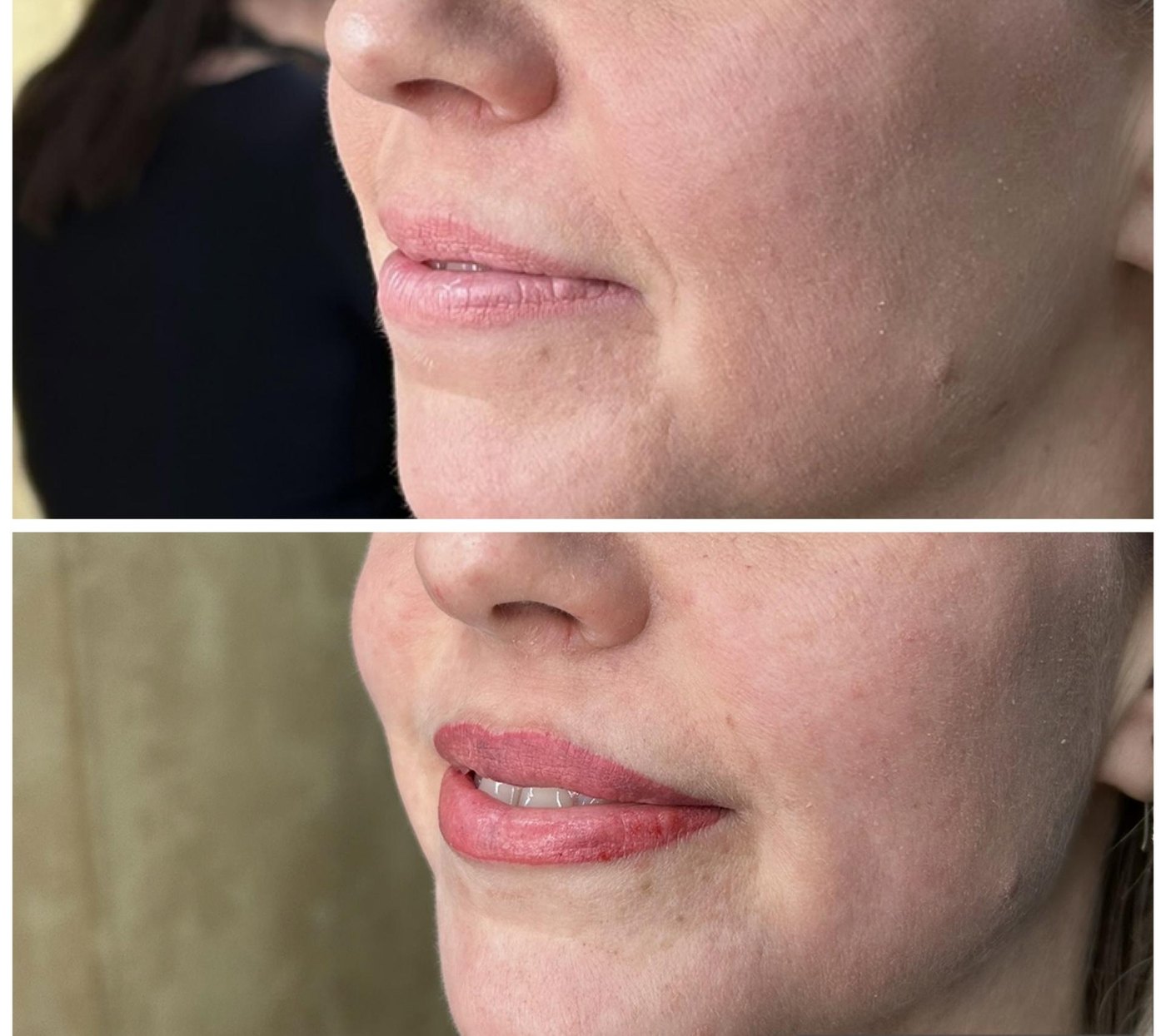 Lip Blush result