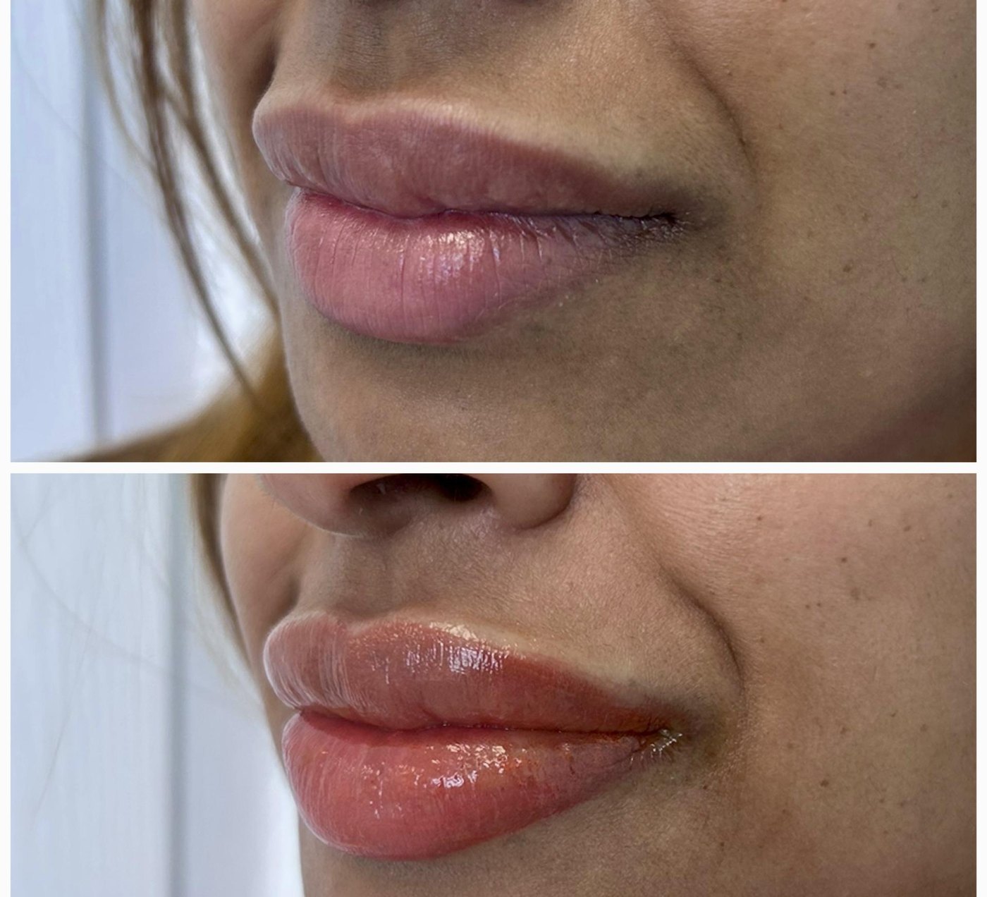 Lip Blush result by Krish Cosmetics Studio